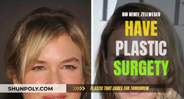 Renee Zellweger's Transformation: Plastic Surgery or Natural Evolution?