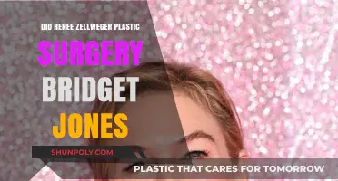 Renee Zellweger's Transformation: Plastic Surgery and Bridget Jones' Legacy