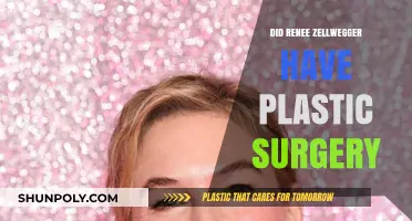 Renee Zellweger Plastic Surgery: Fact-Checking the Transformation Rumors
