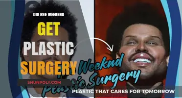 Did The Weeknd Undergo Plastic Surgery? Unraveling the Transformation Rumors
