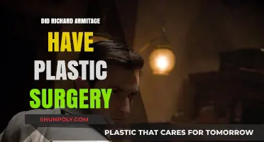 Richard Armitage's Transformation: Plastic Surgery Rumors Explored