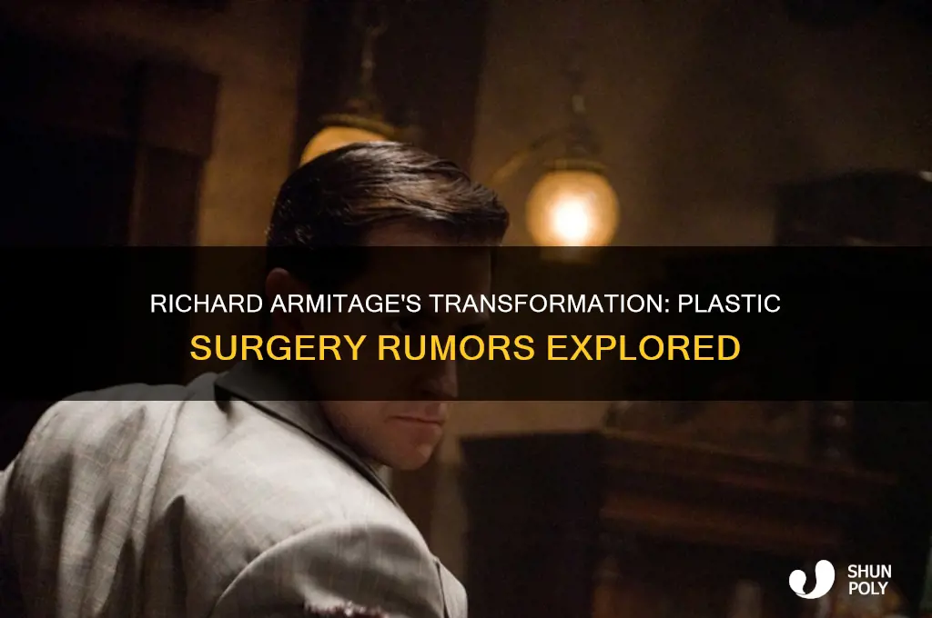 did richard armitage have plastic surgery