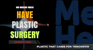 Richard Greco's Transformation: Plastic Surgery Speculations and Truths Revealed