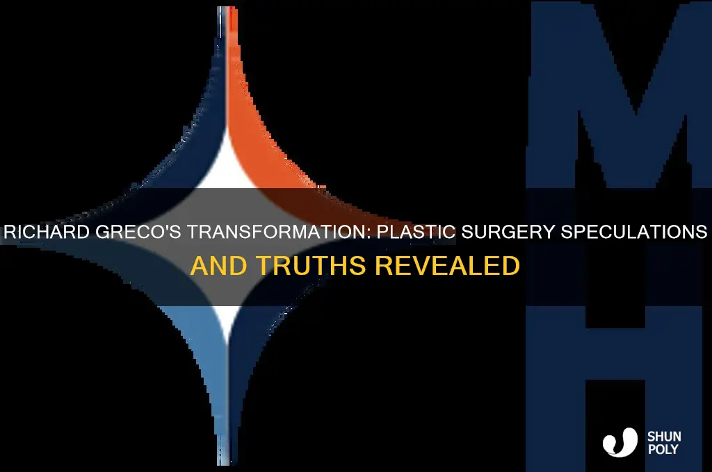 did richard greco have plastic surgery