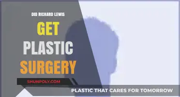 Richard Lewis Plastic Surgery: Fact-Checking the Rumors and Speculations