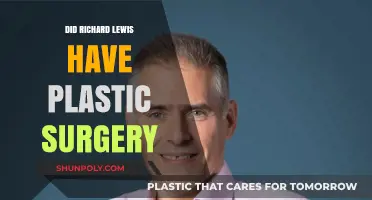 Richard Lewis Plastic Surgery: Fact-Checking the Rumors and Speculations