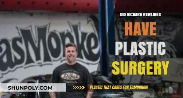 Richard Rawlings Plastic Surgery: Fact-Checking the Rumors and Speculations