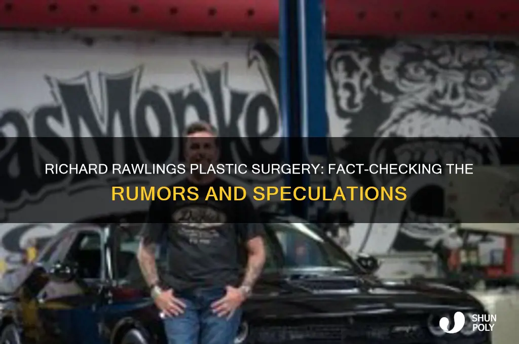 did richard rawlings have plastic surgery