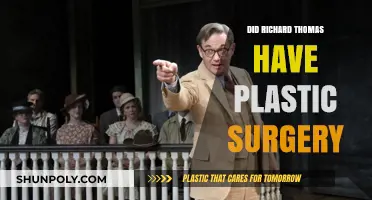 Richard Thomas Plastic Surgery: Fact-Checking the Actor's Transformation Rumors