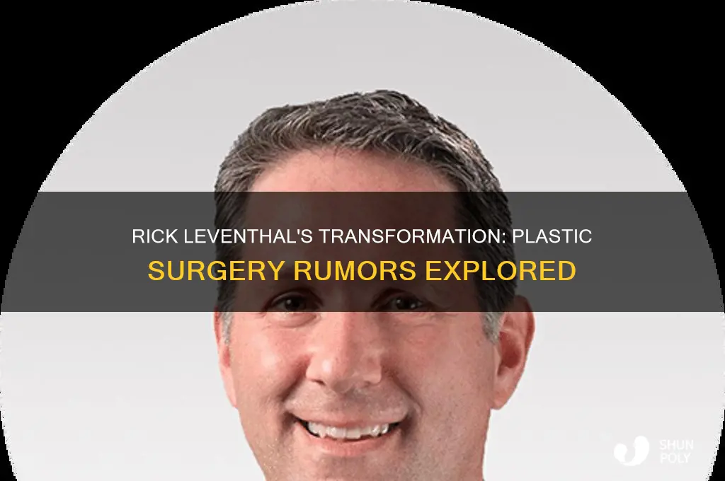 did rick leventhal get plastic surgery
