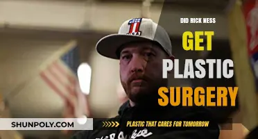 Rick Ness Plastic Surgery: Fact-Checking the Gold Rush Star's Transformation