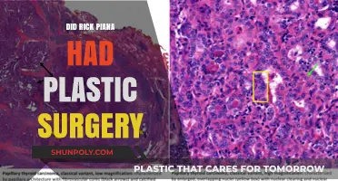 Did Rick Piana Undergo Plastic Surgery? Uncovering the Truth