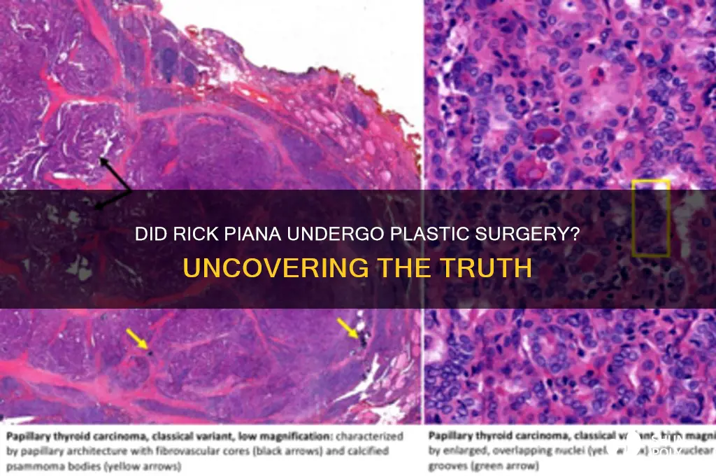 did rick piana had plastic surgery
