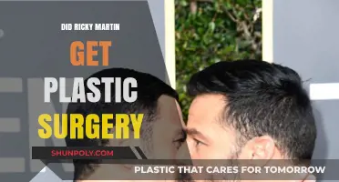 Ricky Martin's Transformation: Plastic Surgery Rumors Explored and Debunked