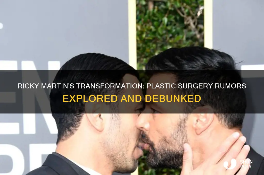 did ricky martin get plastic surgery
