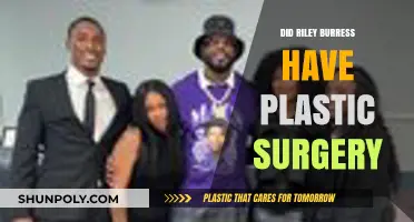 Riley Burress Plastic Surgery: Fact-Checking the Transformation Rumors