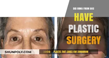 Rima from BGC: Plastic Surgery Speculations and Transformation Truths