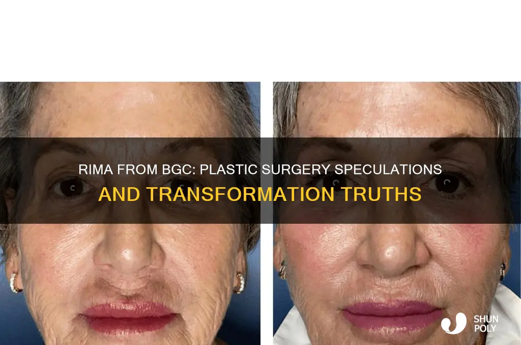 did rima from bgc have plastic surgery