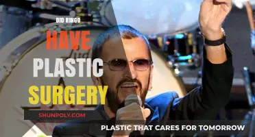 Did Ringo Starr Undergo Plastic Surgery? Unveiling the Truth