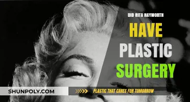 Rita Hayworth's Transformation: Unveiling the Truth About Plastic Surgery