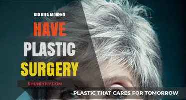 Rita Moreno's Ageless Beauty: Plastic Surgery Speculations Explored