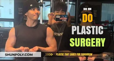 Did RM Get Plastic Surgery? Unraveling the BTS Star's Transformation