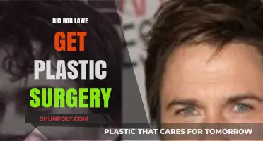 Rob Lowe's Transformation: Plastic Surgery Rumors Explored and Debunked