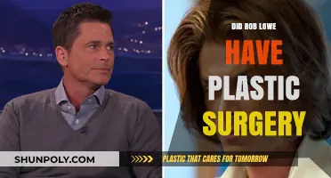Rob Lowe's Youthful Look: Plastic Surgery Rumors Explored