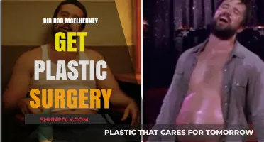 Rob McElhenney's Transformation: Plastic Surgery Rumors Explored