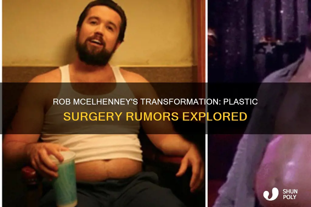 did rob mcelhenney get plastic surgery
