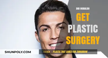 Robaldo's Transformation: Unveiling the Truth About Plastic Surgery Rumors
