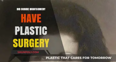 Robbie Montgomery's Transformation: Plastic Surgery Speculations and Truths