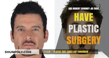 Robert Downey Jr.'s Transformation: Plastic Surgery Rumors Explored