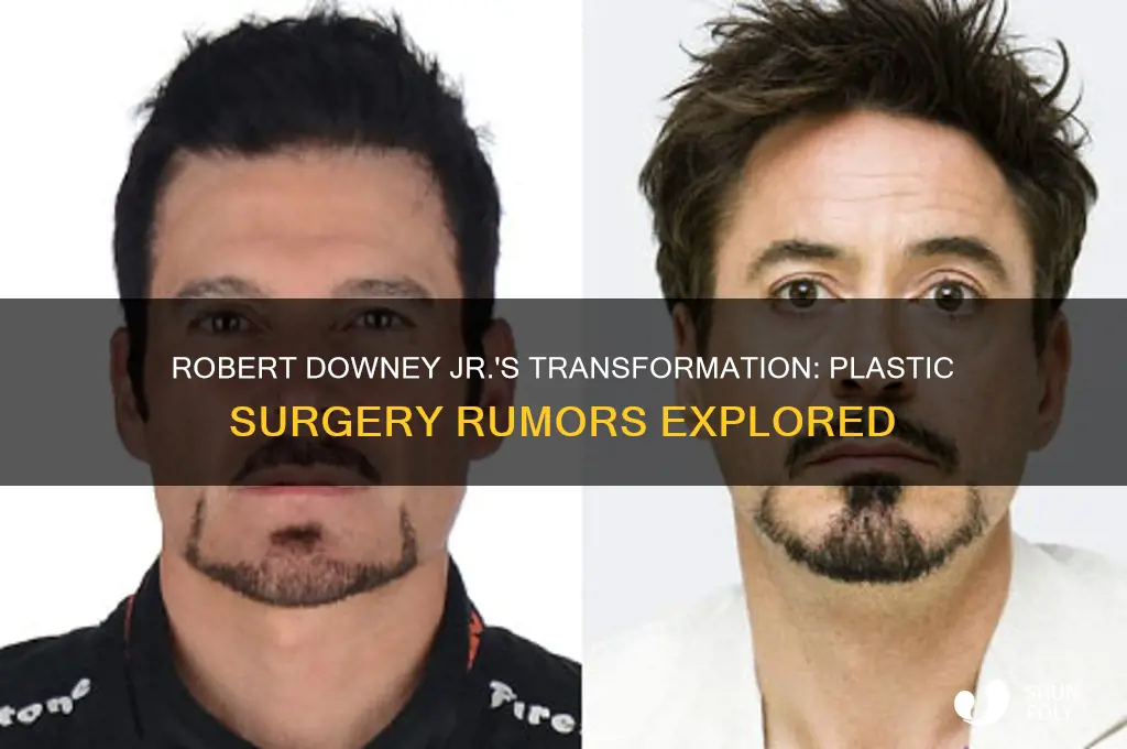 did robert downey jr ever have plastic surgery