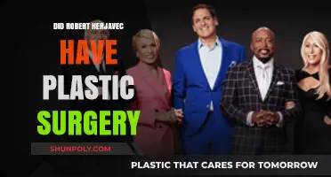 Robert Herjavec's Transformation: Plastic Surgery Rumors Explored
