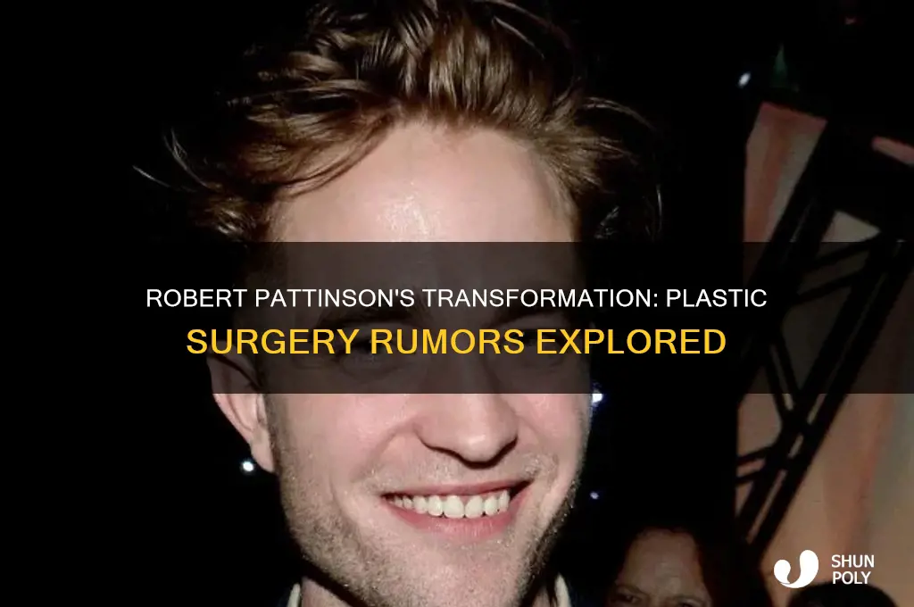 did robert pattinson get plastic surgery