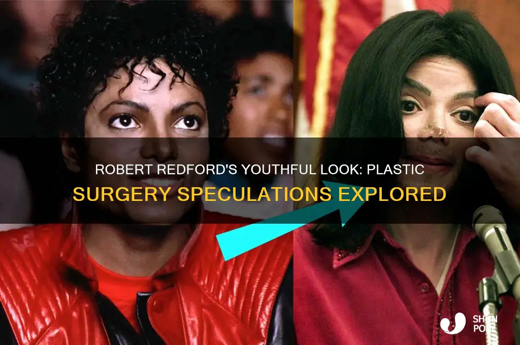 did robert redford have plastic surgery