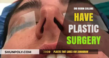 Robin Collins Plastic Surgery: Fact-Checking the Rumors and Speculations