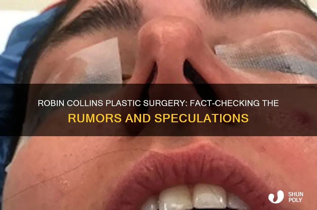 did robin collins have plastic surgery
