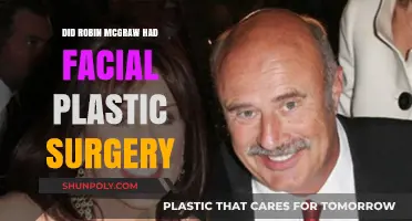 Robin McGraw's Facial Transformation: Plastic Surgery Speculations Explored