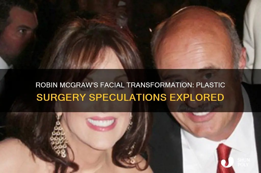 did robin mcgraw had facial plastic surgery