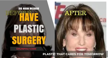 Robin McGraw Plastic Surgery: Fact-Checking the Rumors and Speculations