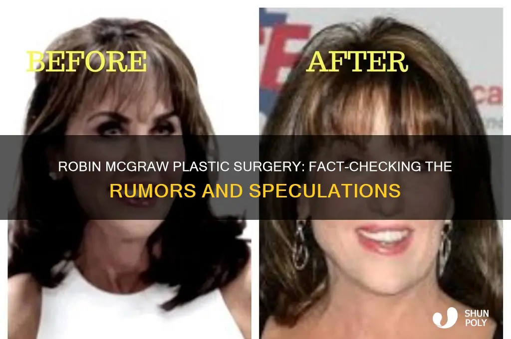 did robin mcgraw have plastic surgery