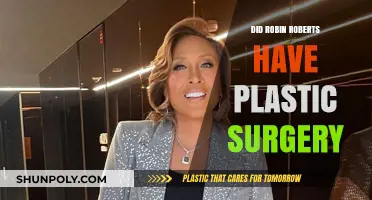 Robin Roberts Plastic Surgery: Fact-Checking the Rumors and Speculations