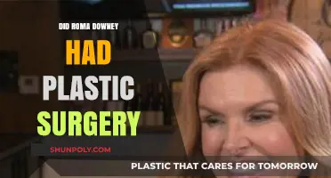 Roma Downey Plastic Surgery: Fact or Fiction? Unveiling the Truth