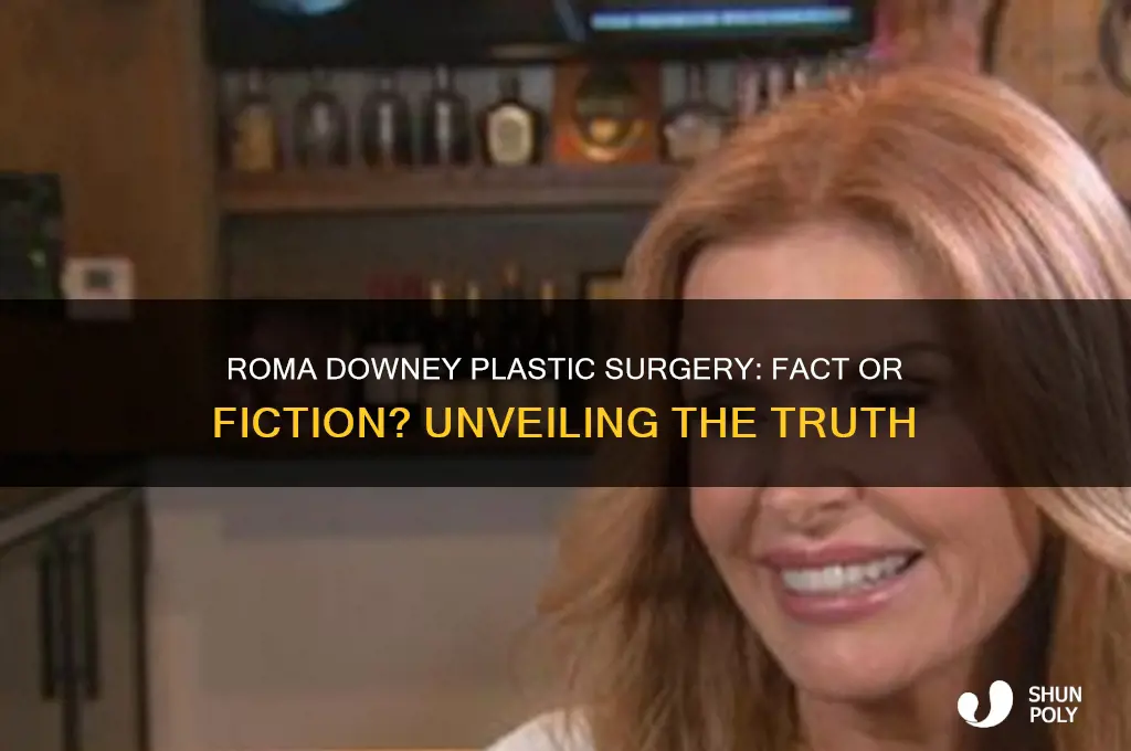 did roma downey had plastic surgery