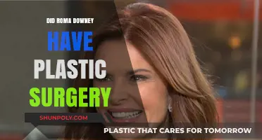 Roma Downey's Transformation: Plastic Surgery Rumors Explored