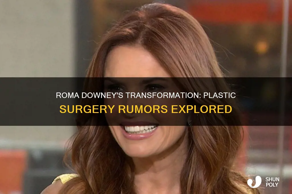 did roma downey have plastic surgery