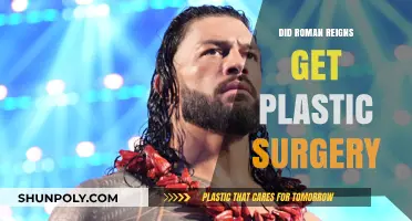 Roman Reigns Plastic Surgery Rumors: Fact or Fiction?