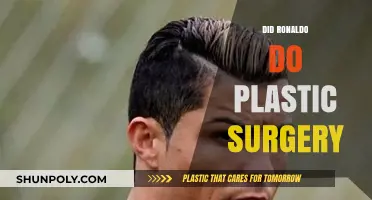 Ronaldo's Transformation: Unveiling the Truth About Plastic Surgery Rumors